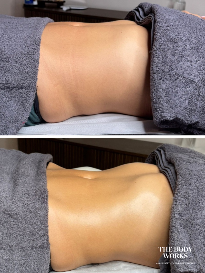 Manual lymphatic drainage treatment environment Cheshire