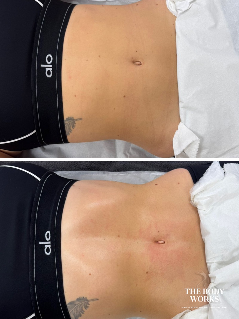 Peaceful lymphatic drainage therapy room